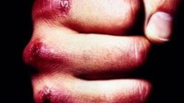 Bauskā starp vairākiem jauniešiem izcēlies konflikts; uzsākts kriminālprocess