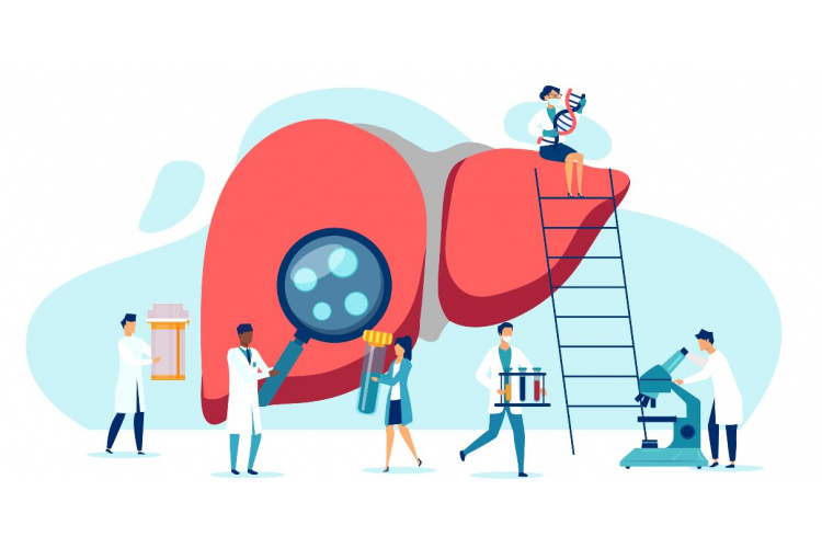 Hepatīts, taukainā hepatoze – izplatītas, taču bieži vien nediagnosticētas slimības.