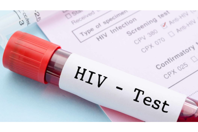 Andris Veiķenieks – HIV vīrusu aizvien maldīgi neattiecinām uz sevi, tāpēc neveicam testus