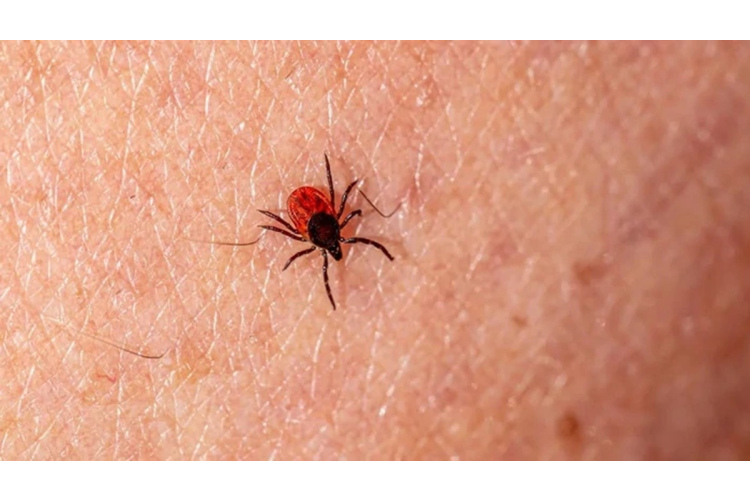 Kā apģērba krāsa ietekmē ērču piesaistīšanu: praktiski ieteikumi drošībai